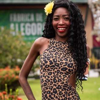 Alessandra Silva ganhou prótese da Grande Rio