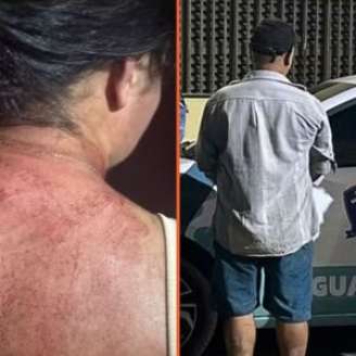 A vítima foi atendida em um hospital e precisou levar pontos na cabeça.