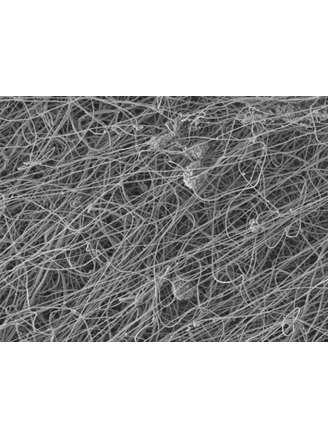 <p>Imagem mostra 'molde' de nanofibras três dias após receber células-tronco</p>