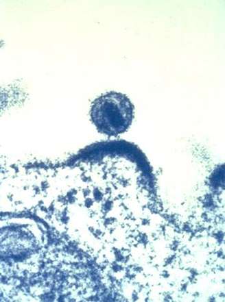 <p>Imagem de microscópio mostra o vírus da imunodeficiência humana (HIV) brotando de uma célula imune, que o vírus infecta e usa para se replicar: estudo sugere nova abordagem para cura</p>