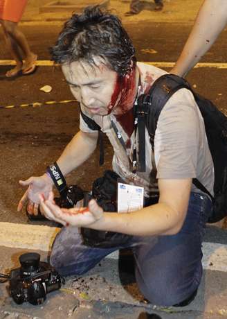 <p>Yasuyoshi Chiba disse que foi atingido na cabeça durante a cobertura do protesto</p>