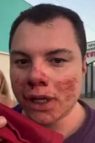 Clóvis Roberto de Leão afirma ter sido atacado ao tentar intervir em confusão durante evento universitário.