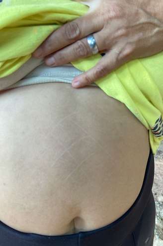 Homem é preso após usar faca para fazer ‘jogo da velha’ na barriga da esposa