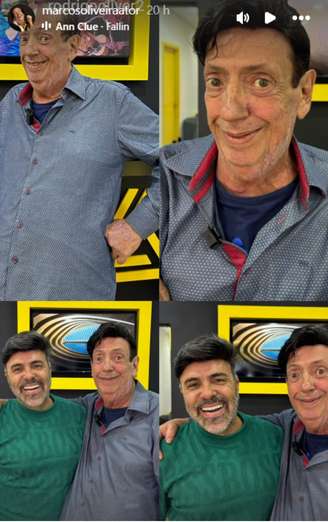 Ator revela antes e depois em suas redes sociais