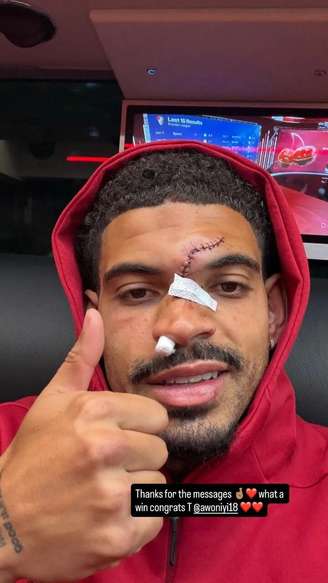 Gibbs-White mostra o rosto deformado por causa do violento choque de cabeça – Reprodução/Instagram